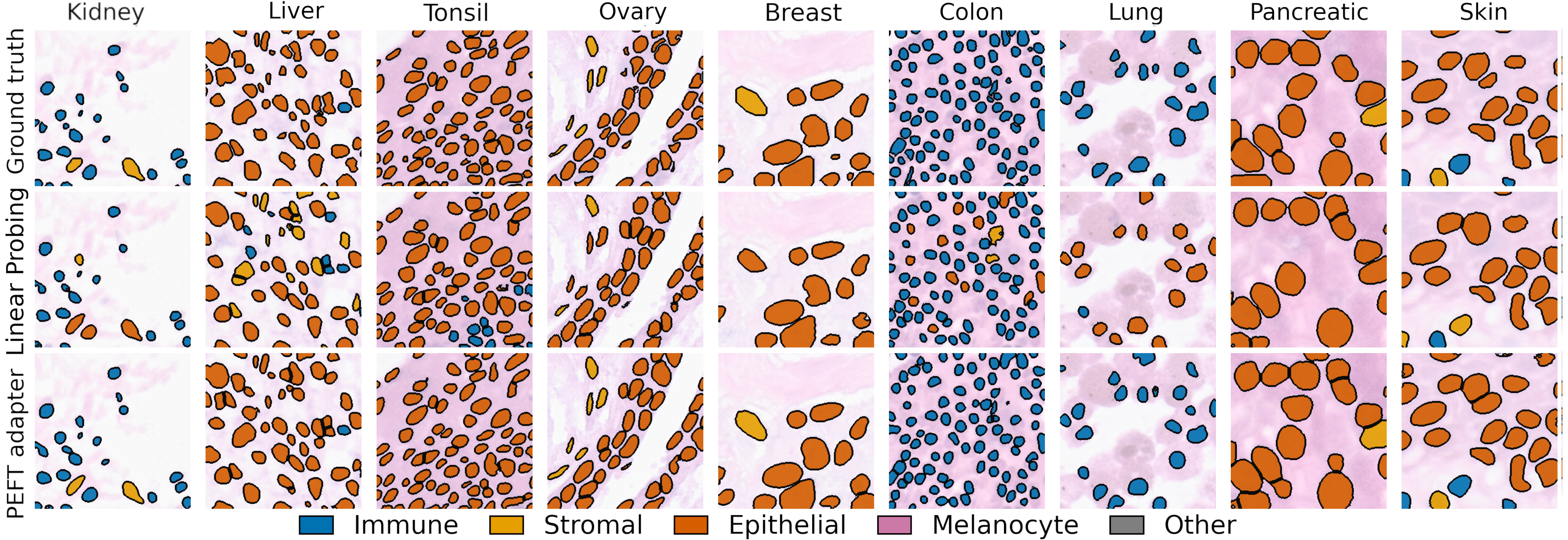 Ground truth, linear probing, and selected PEFT predictions across nine tissues