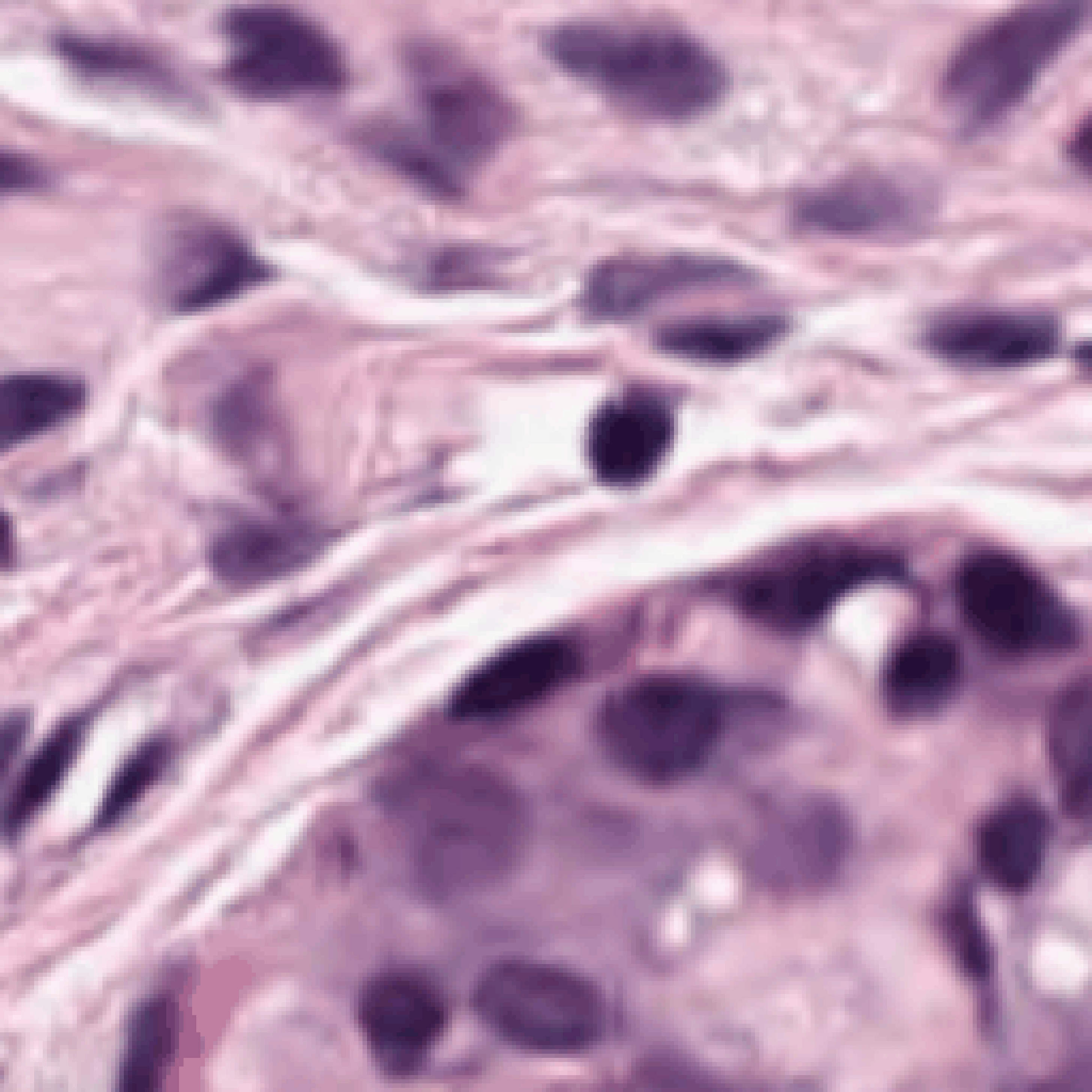 Graph-PanNuke teaser – cell-graph construction from a histopathology patch